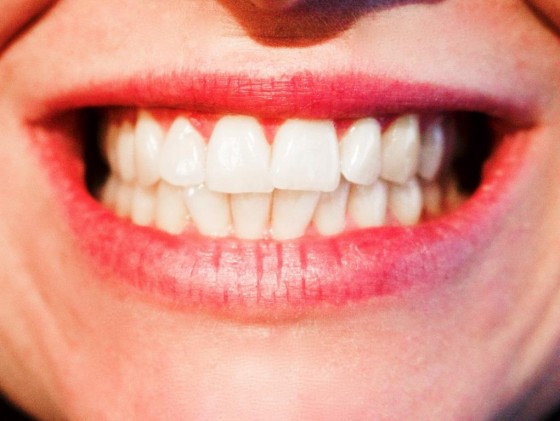 Um auf Schnappschüssen zu glänzen, empfiehlt sich ein zauberhaftes Lächeln. - copyright: pixabay.com