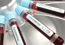 NRW beschließt umfangreiche Maßnahmen gegen das Coronavirus copyright: Envato / ktsimage