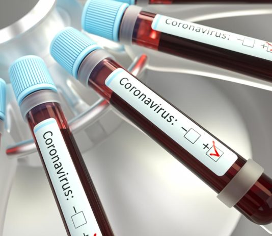 NRW beschließt umfangreiche Maßnahmen gegen das Coronavirus copyright: Envato / ktsimage